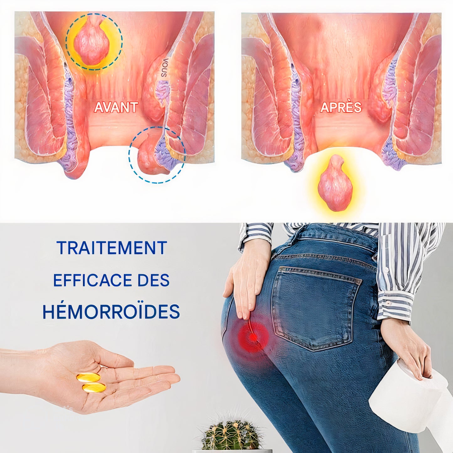 Capsules à base de plantes Biancat™AnalEase pour la réparation deshémorroïdes🌿🌿